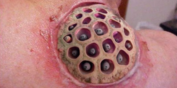 Fiore di loto bufala