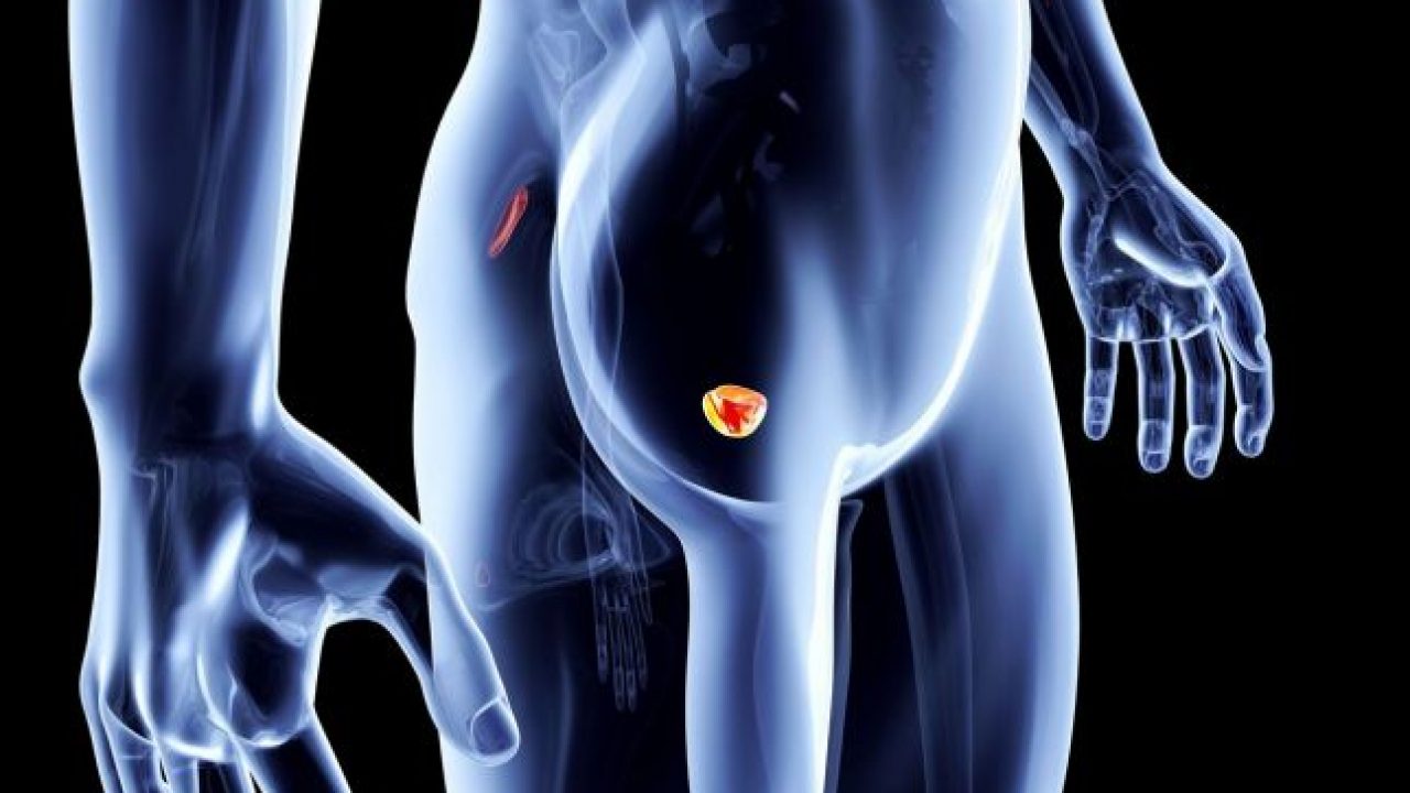 Riabilitazione della disfunzione erettile dopo prostatectomia radicale
