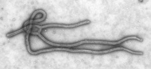 Il virus ebola al microscopio eletronico. Credit: Wikipedia.org