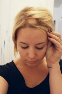 alopecia