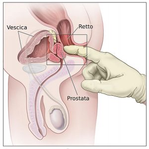ESPLORAZIONE RETTALE DIGITALE