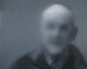 DEGENERAZIONE MACULARE SENILE - Copia