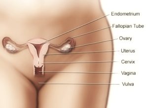TUMORE VAGINA 1 - Copia