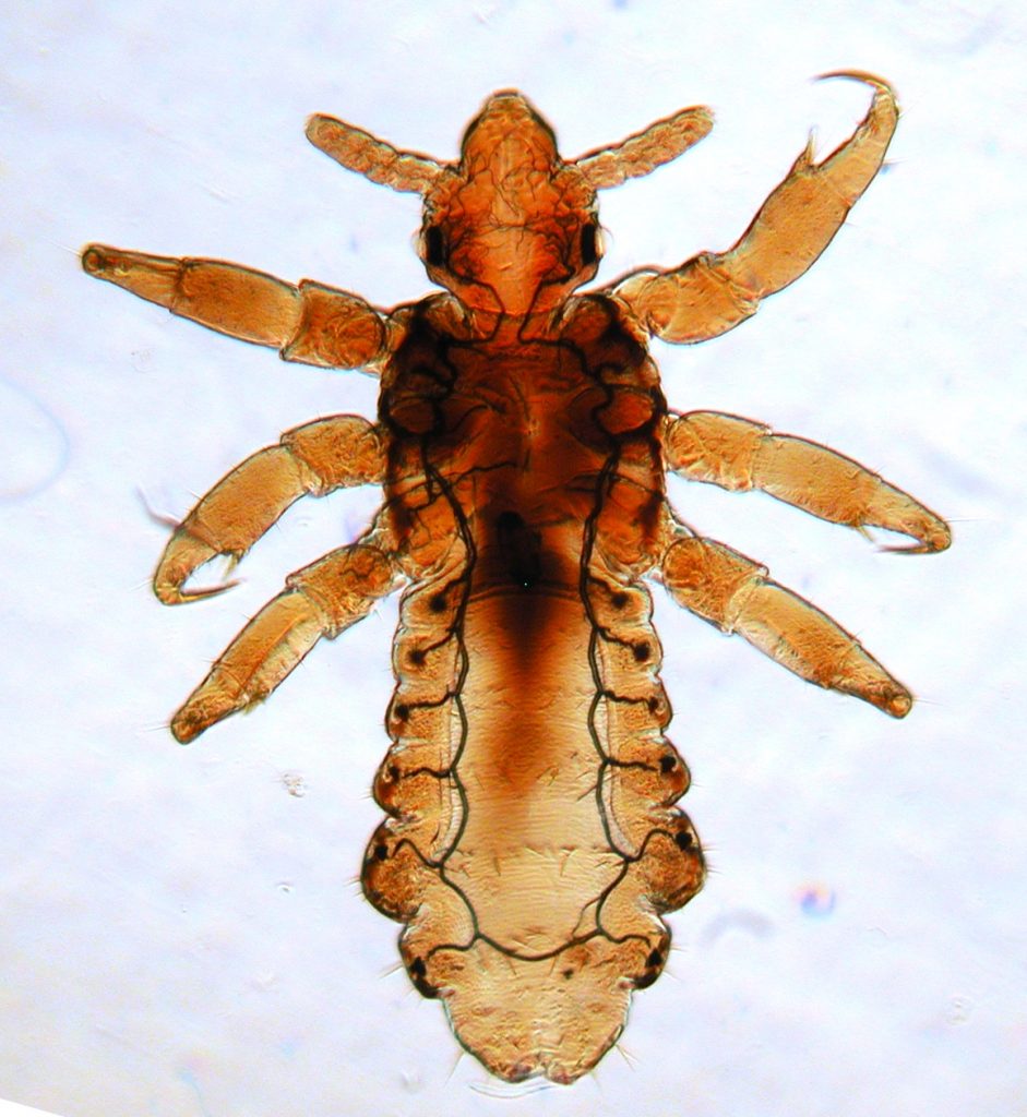 pidocchi