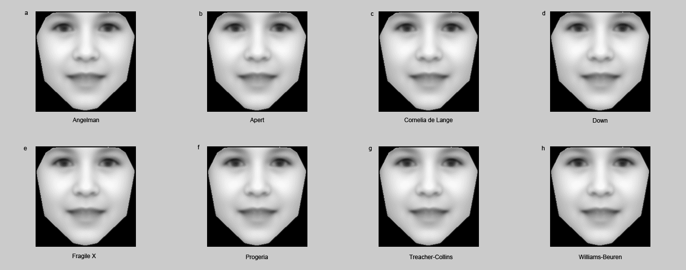 computer vision_figure1