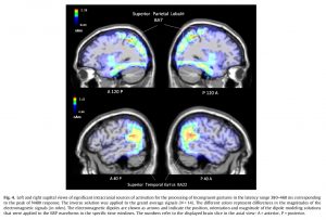Aree cerebrali stimolate dalla presenza di un’incongruenza nella comunicazione gestuale