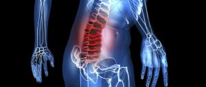 SCIATICA COP
