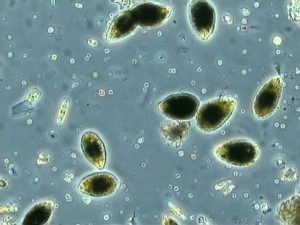 ALGA 1