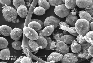 ALGA 2