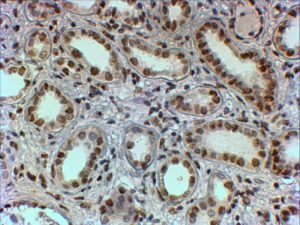 PTBP1-Antibody-Immunohistochemistry-Paraffin-NB100-1310-img0003