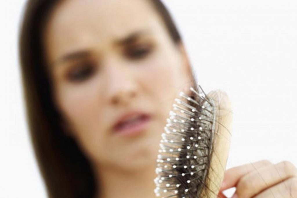 alopecia