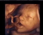 babypod2