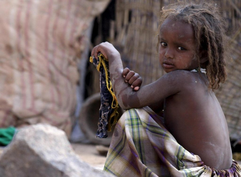 Etiopia, la peggiore siccità negli ultimi 30 anni