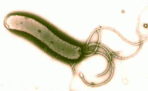 400px-H.pylori
