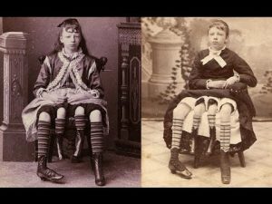 Myrtle Corbin