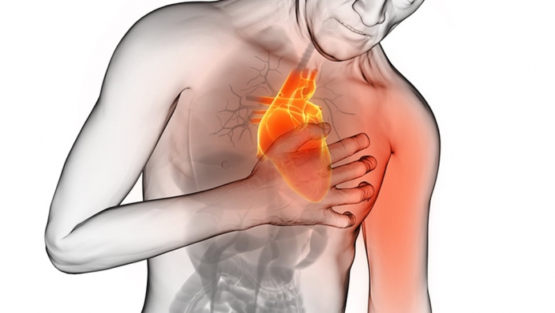 Infarto del miocardio: cause e fattori di rischio, diagnosi, cura e  prevenzione