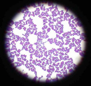 Staphylococcus aureus