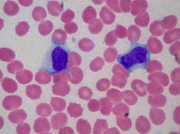 MONONUCLEOSI COP