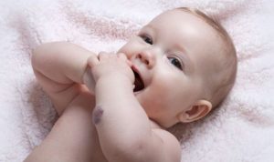 emangioma-infantile-vascolari-bambini-centri-22598