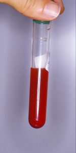 URINEconsangue