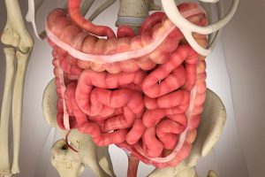 SINDROME INTESTINO IRRITABILE 2