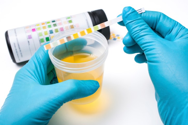 urine-4