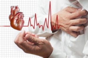 ANGINA COP