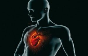 CARDIOPATIA ISCHEMICA 1
