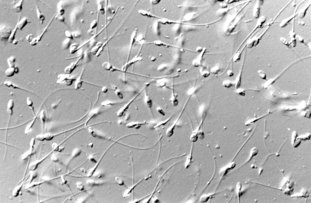 spermatozoi microscopio