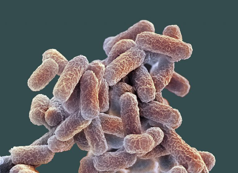 batteri e.coli