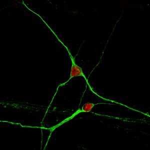 cervello umano neurone