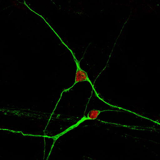 cervello umano neurone