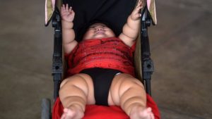 bambino obeso