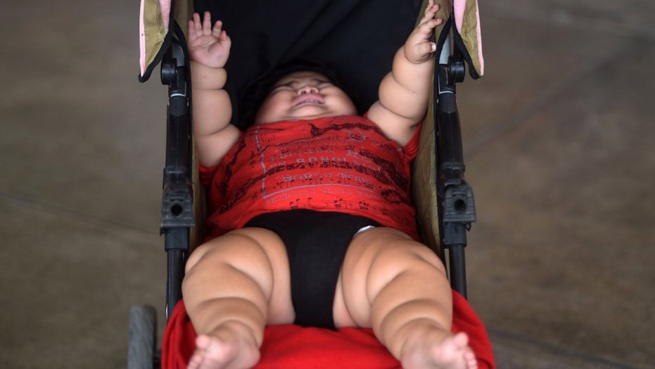 bambino obeso