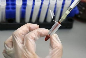 analisi del sangue