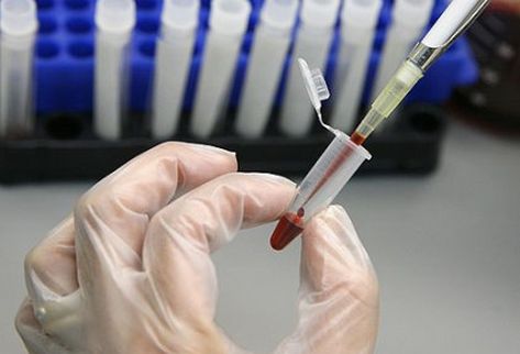 analisi del sangue
