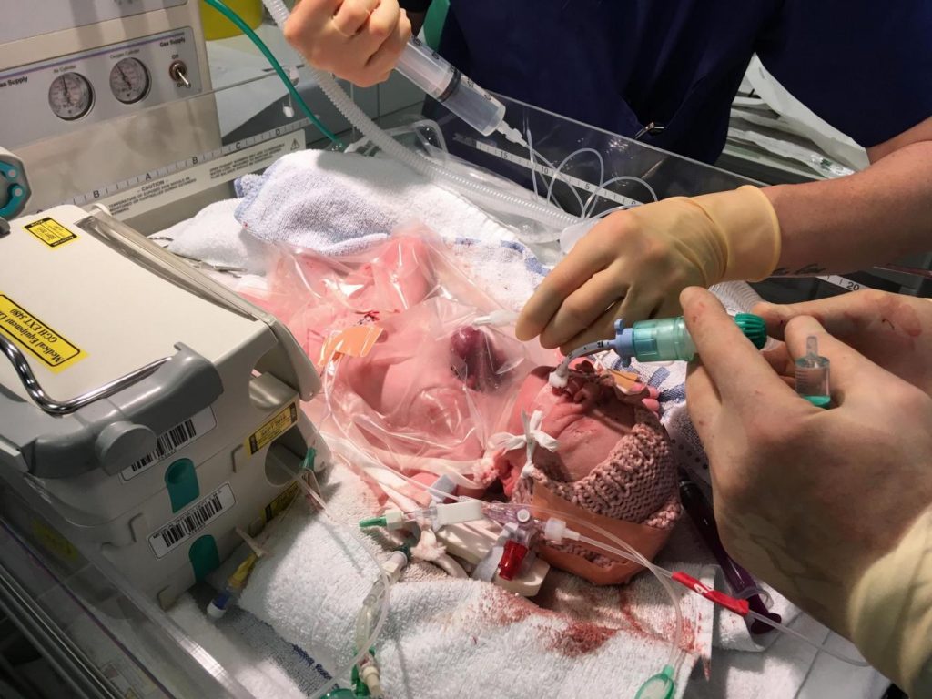 Cuore fuori dal petto