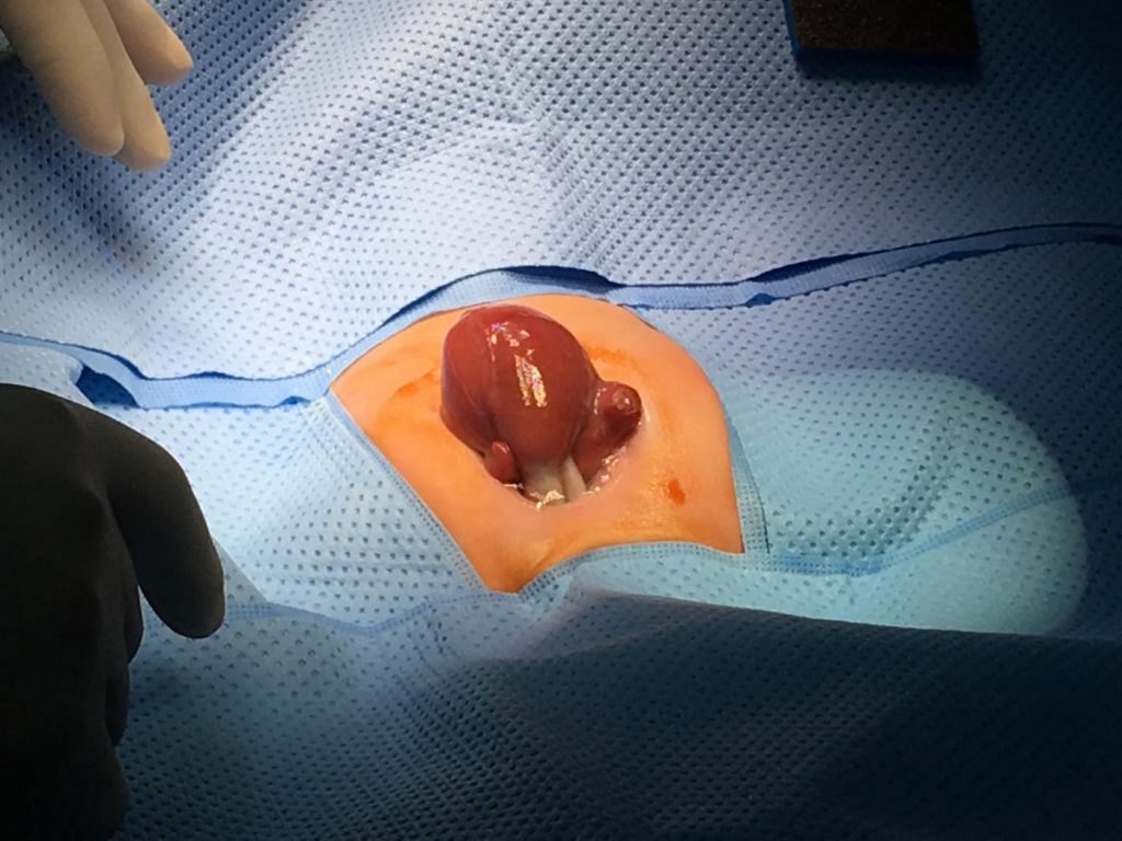 Cuore fuori dal petto
