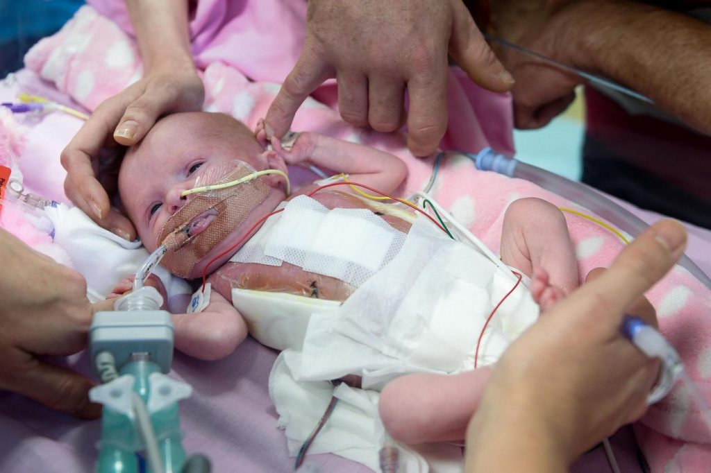 Cuore fuori dal petto