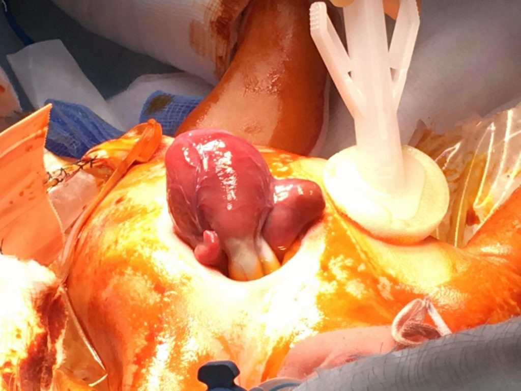 Cuore fuori dal petto