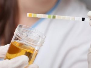 Urine