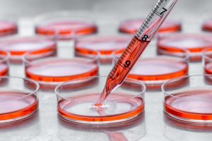 biopsia liquida tumori ricerca medica