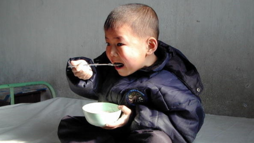 malnutrizione corea del nord