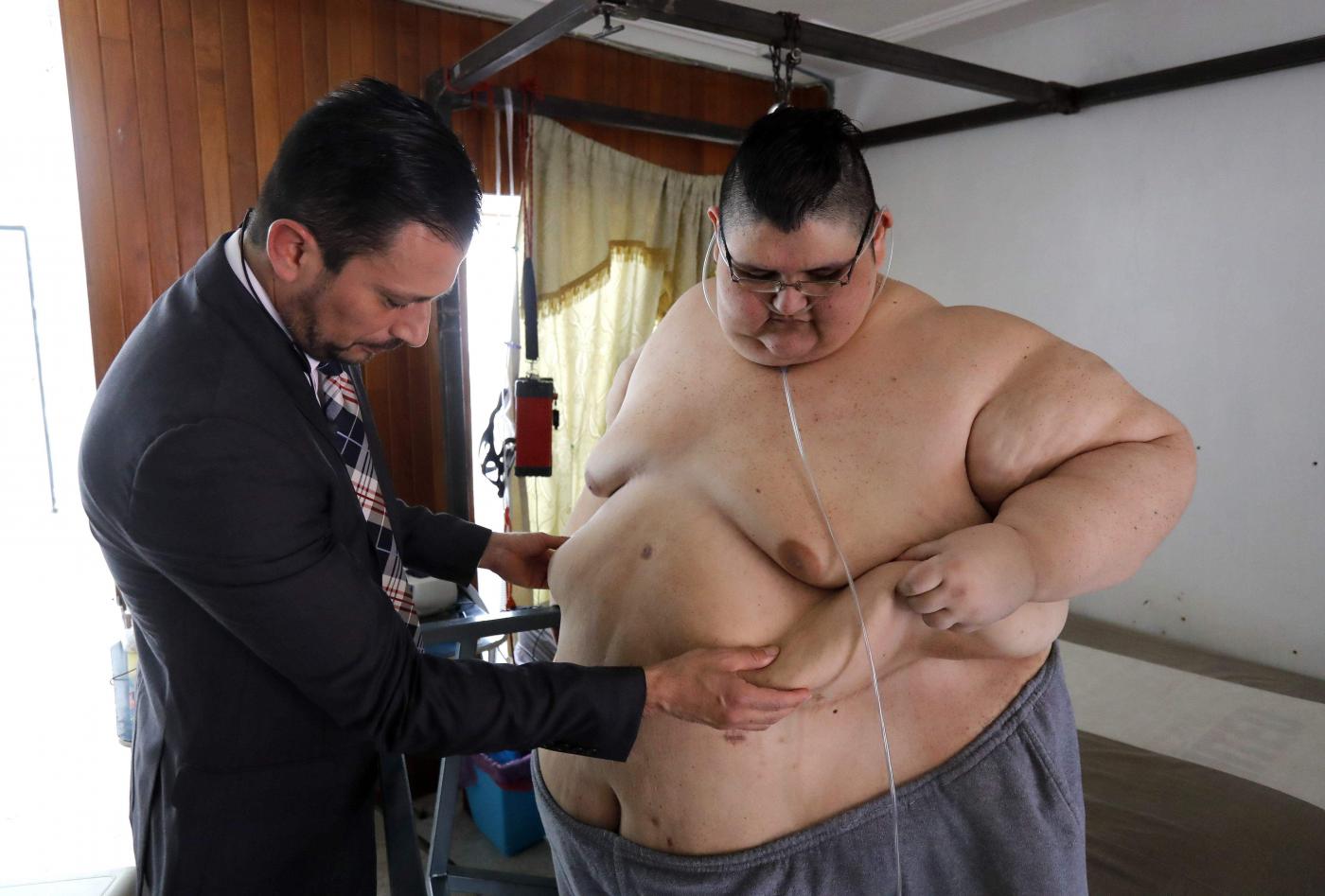 Messico uomo più grasso del mondo