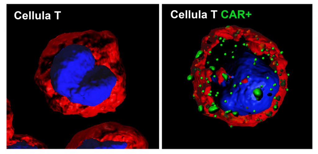 terapia genica bambino gesù1
