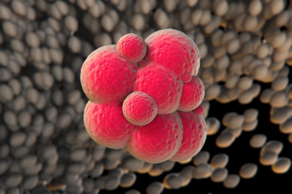 conservare cellule staminali