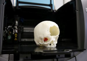 stampa 3d tumori