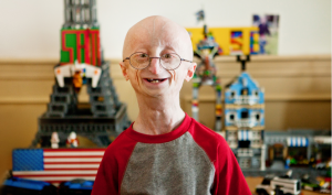 progeria