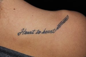 tatuaggi rimozione