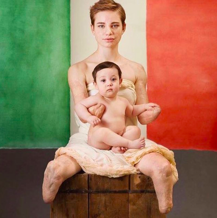 bebe vio vaccini
